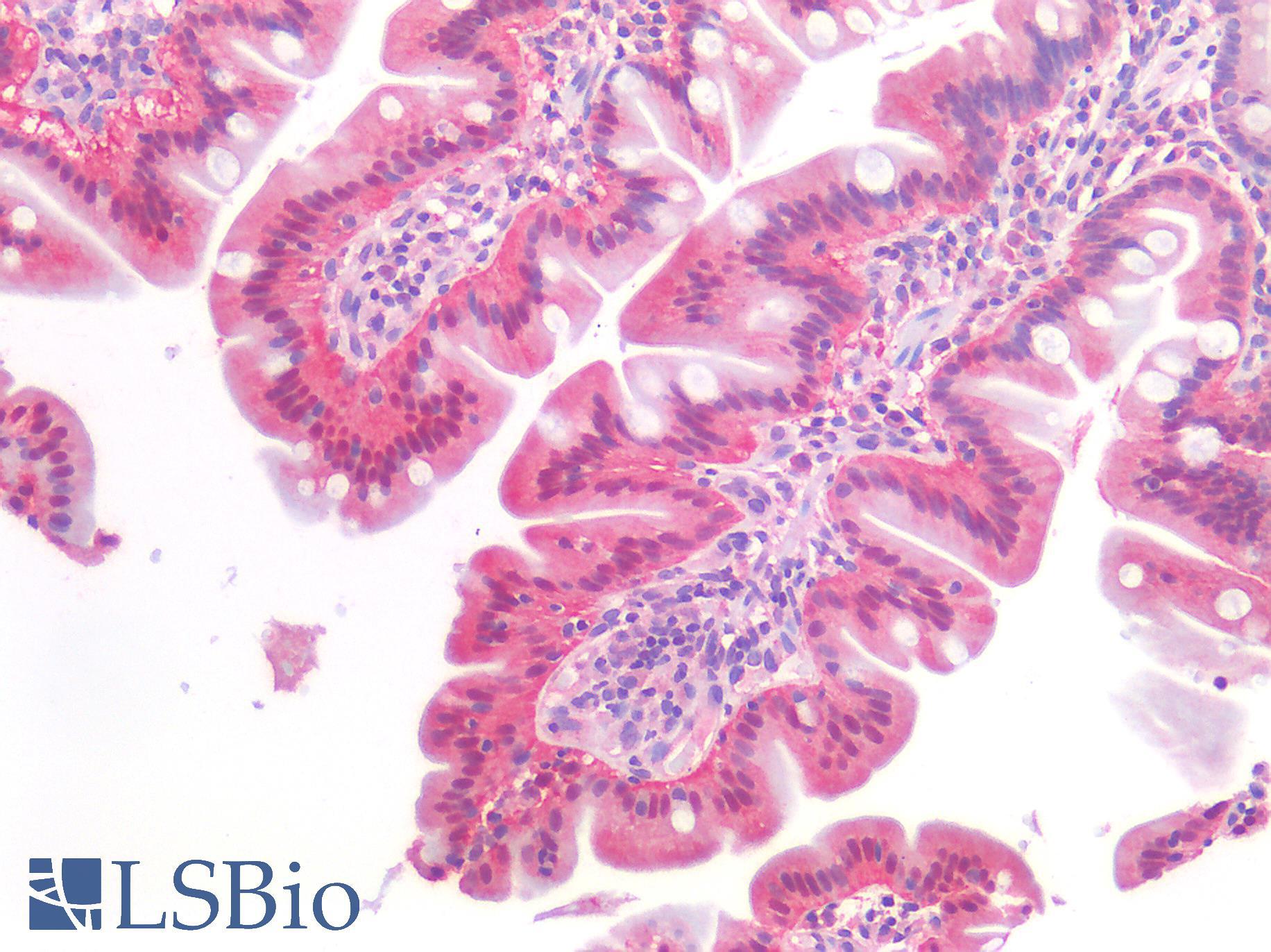 ERBB3 / HER3 Antibody - Human Small Intestine: Formalin-Fixed, Paraffin-Embedded (FFPE)
