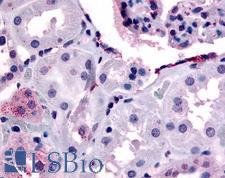 ERBB4 / HER4 Antibody - Anti-ERBB4 antibody IHC of human glomerulus and renal tubular epithelium in cortex. Immunohistochemistry of formalin-fixed, paraffin-embedded tissue after heat-induced antigen retrieval.