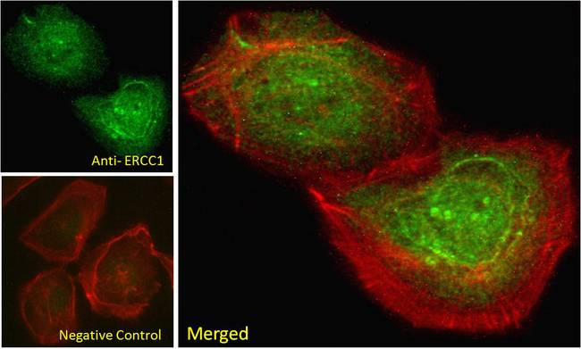 ERCC1 Antibody - Goat Anti-ERCC1 Antibody Immunofluorescence analysis of paraformaldehyde fixed U2OS cells, permeabilized with 0.15% Triton. Primary incubation 1hr (10ug/ml) followed by Alexa Fluor 488 secondary antibody (2ug/ml), showing nuclear staining. Actin filaments were stained with phalloidin (red). Negative control: Unimmunized goat IgG (10ug/ml) followed by Alexa Fluor 488 secondary antibody (2ug/ml).