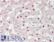 ERCC3 / XPB Antibody - Human Liver: Formalin-Fixed, Paraffin-Embedded (FFPE)