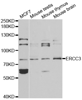 ERCC3 / XPB Antibody - Western blot analysis of extracts of various cell lines, using ERCC3 antibody at 1:1000 dilution. The secondary antibody used was an HRP Goat Anti-Rabbit IgG (H+L) at 1:10000 dilution. Lysates were loaded 25ug per lane and 3% nonfat dry milk in TBST was used for blocking.