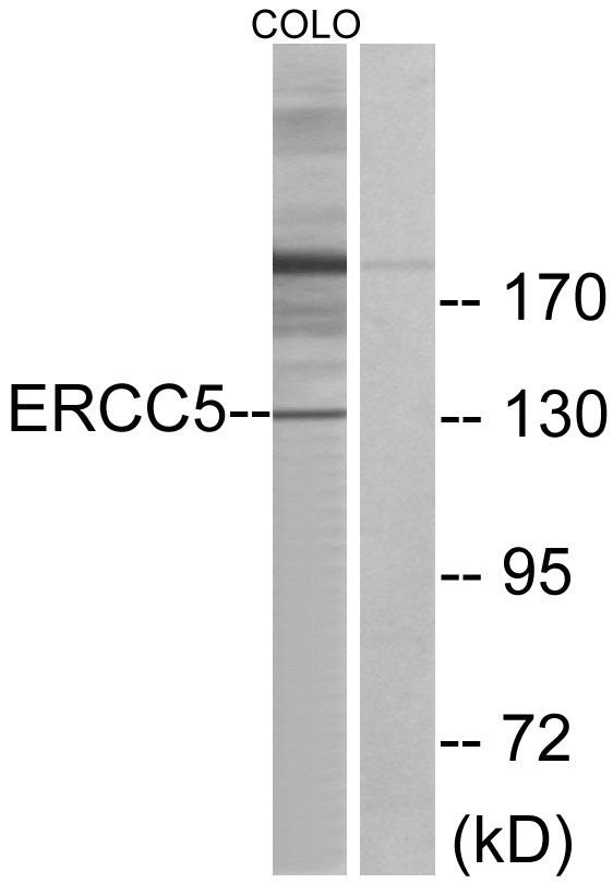 ERCC5 / XPG Antibody - Western blot analysis of lysates from COLO cells, using ERCC5 Antibody. The lane on the right is blocked with the synthesized peptide.