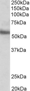 ERG Antibody - Goat Anti-ERG Antibody (0.1µg/ml) staining of MOLT4 lysate (35µg protein in RIPA buffer). Detected by chemiluminescencence.