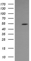 ERG Antibody - HEK293T cells were transfected with the pCMV6-ENTRY control (Left lane) or pCMV6-ENTRY ERG (Right lane) cDNA for 48 hrs and lysed. Equivalent amounts of cell lysates (5 ug per lane) were separated by SDS-PAGE and immunoblotted with anti-ERG.