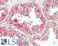 ERGIC-53 / LMAN1 Antibody - Human Prostate: Formalin-Fixed, Paraffin-Embedded (FFPE)