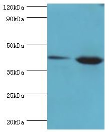 ERGIC2 Antibody - Western blot. All lanes: Endoplasmic reticulum-Golgi intermediate compartment protein 2 antibody at 4 ug/ml. Lane 1: HepG2 whole cell lysate. Lane 2: Jurkat whole cell lysate. secondary Goat polyclonal to rabbit at 1:10000 dilution. Predicted band size: 43 kDa. Observed band size: 43 kDa.