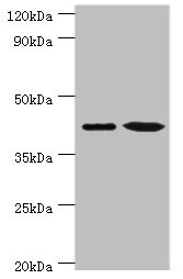 ERGIC2 Antibody - Western blot All lanes: Endoplasmic reticulum-Golgi intermediate compartment protein 2 antibody at 4µg/ml Lane 1: HepG2 whole cell lysate Lane 2: Jurkat whole cell lysate Secondary Goat polyclonal to rabbit IgG at 1/10000 dilution Predicted band size: 43 kDa Observed band size: 43 kDa