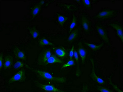 ERGIC3 Antibody - Immunofluorescent analysis of Hela cells using ERGIC3 Antibody at dilution of 1:100 and Alexa Fluor 488-congugated AffiniPure Goat Anti-Rabbit IgG(H+L)