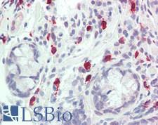 ERIC-1 / TACC3 Antibody - Human Small Intestine: Formalin-Fixed, Paraffin-Embedded (FFPE), at a dilution of 1:100. 