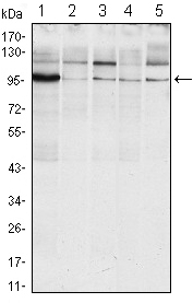 ERN1 / IRE1 Antibody - Western blot using ERN1 mouse monoclonal antibody against Raji (1), A431 (2), Jurkat (3), HeLa(4) and HEK293 (5) cell lysate.