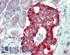 ERO1LB Antibody - Human Pancreas: Formalin-Fixed, Paraffin-Embedded (FFPE)