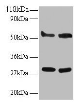 ERP29 Antibody - Western blot All lanes: Endoplasmic reticulum resident protein 29 antibody at 2µg/ml Lane 1: EC109 whole cell lysate Lane 2: 293T whole cell lysate Secondary Goat polyclonal to rabbit IgG at 1/15000 dilution Predicted band size: 29, 6 kDa Observed band size: 29, 33, 55 kDa