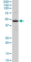 ERP44 Antibody - Western blot of TXNDC4 expression in A-431.