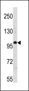 ESCO1 / ECO1 Antibody - ESCO1 Antibody western blot of 293 cell line lysates (35 ug/lane). The ESCO1 antibody detected the ESCO1 protein (arrow).