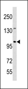 ESCO1 / ECO1 Antibody - ESCO1 Antibody western blot of mouse spleen tissue lysates (35 ug/lane). The ESCO1 antibody detected the ESCO1 protein (arrow).