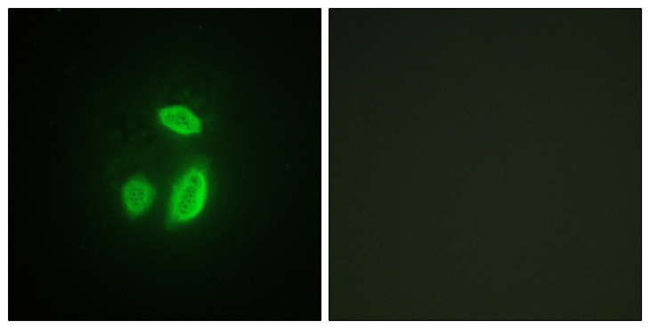 ESPL1 / Separase Antibody - Immunofluorescence analysis of HUVEC cells, using SEPARASE Antibody. The picture on the right is blocked with the synthesized peptide.