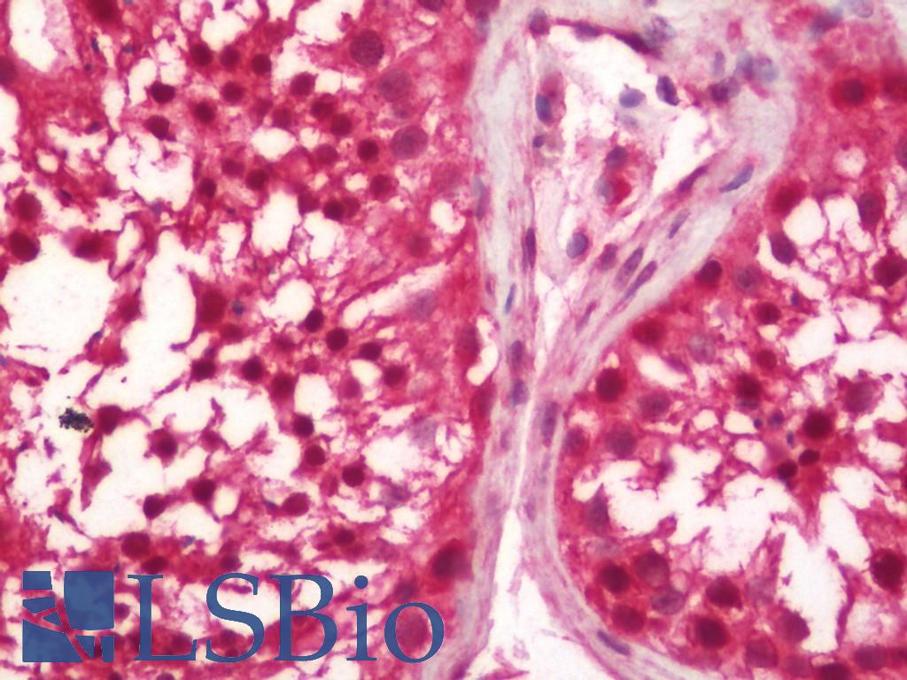 ESR2 / ER Beta Antibody - Human Testis: Formalin-Fixed, Paraffin-Embedded (FFPE).  This image was taken for the unconjugated form of this product. Other forms have not been tested.
