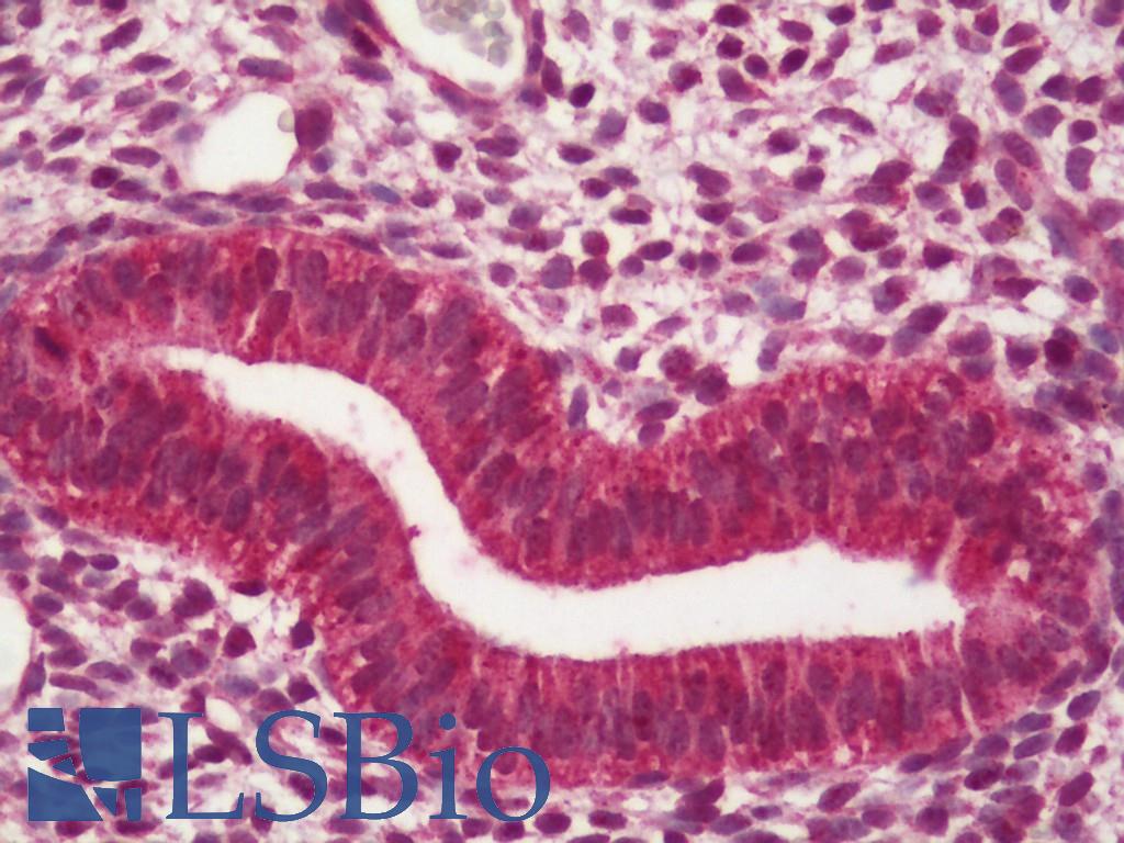 ESR2 / ER Beta Antibody - Human Uterus, Endometrium: Formalin-Fixed, Paraffin-Embedded (FFPE).  This image was taken for the unconjugated form of this product. Other forms have not been tested.