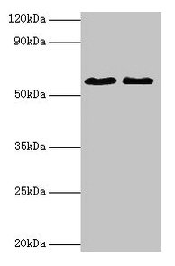 ESR2 / ER Beta Antibody - Western blot All lanes: Estrogen receptor beta antibody at 2µg/ml Lane 1: Mouse brain tissue Lane 2: PC-3 whole cell lysate Secondary Goat polyclonal to rabbit IgG at 1/10000 dilution Predicted band size: 60, 56, 36, 58, 55, 53, 49, 42, 54 kDa Observed band size: 60 kDa