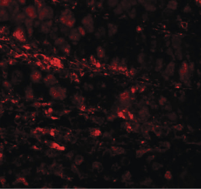 ESRP1 / RBM35A Antibody - Immunofluorescence of RBM35A in human colon tissue cells with RBM35A antibody at 20 ug/ml.