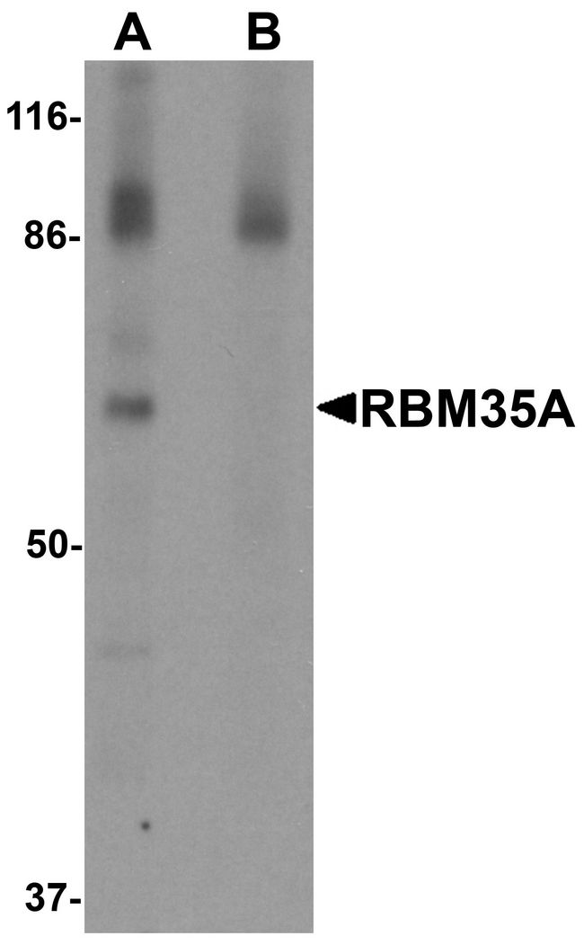 ESRP1 / RBM35A Antibody - Western blot analysis of RBM35A in rat colon tissue lysate with RBM35A antibody at 0.5 ug/ml in (A) the absence and (B) the presence of blocking peptide.