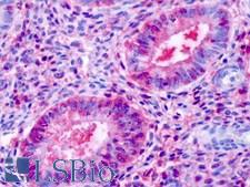ESRRB / ERR Beta Antibody - Anti-ESRRB / ERR-Beta antibody IHC of human uterus, endometrial glands. Immunohistochemistry of formalin-fixed, paraffin-embedded tissue after heat-induced antigen retrieval. Antibody dilution 1 ug/ml.