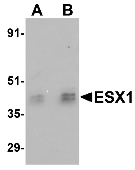 ESX1 Antibody - Western blot analysis of ESX1 in human testis tissue lysate with ESX1 antibody at (A) 1 and (B) 2 ug/ml.