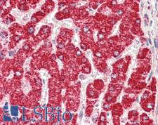 ETFB Antibody - Anti-ETFB antibody IHC staining of human liver. Immunohistochemistry of formalin-fixed, paraffin-embedded tissue after heat-induced antigen retrieval.