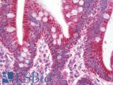 ETHE1 Antibody - Anti-ETHE1 antibody IHC staining of human small intestine. Immunohistochemistry of formalin-fixed, paraffin-embedded tissue after heat-induced antigen retrieval. Antibody dilution 1:100.