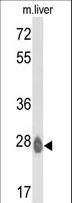 ETHE1 Antibody - Western blot of ETHE1 Antibody in mouse liver tissue lysates (35 ug/lane). ETHE1 (arrow) was detected using the purified antibody.