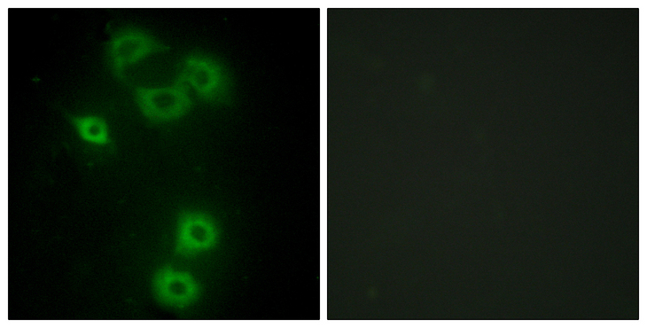 ETK / BMX Antibody - Immunofluorescence analysis of A549 cells, using BMX Antibody. The picture on the right is blocked with the synthesized peptide.