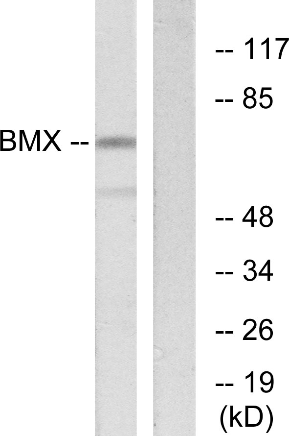 ETK / BMX Antibody - Western blot analysis of lysates from COS7 cells, using BMX Antibody. The lane on the right is blocked with the synthesized peptide.