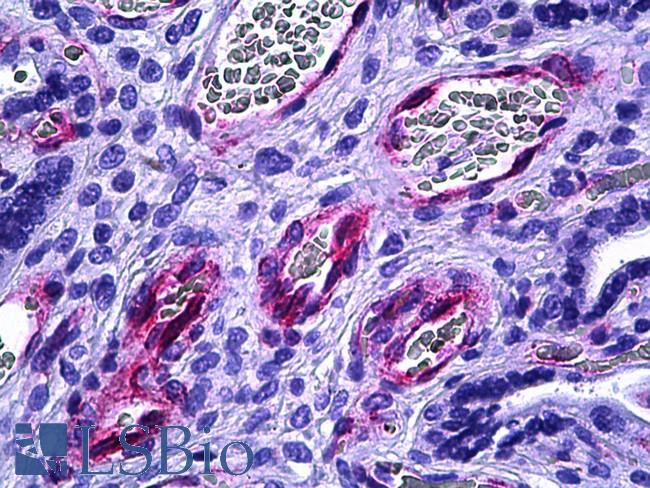 ETK / BMX Antibody - Anti-BMX antibody IHC of human placenta, vessels. Immunohistochemistry of formalin-fixed, paraffin-embedded tissue after heat-induced antigen retrieval. Antibody dilution 1:50.