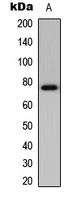 ETK / BMX Antibody - Western blot analysis of BMX expression in mouse brain (A) whole cell lysates.
