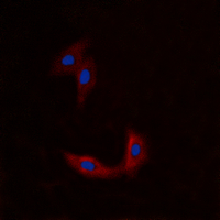 ETK / BMX Antibody - Immunofluorescent analysis of BMX staining in A549 cells. Formalin-fixed cells were permeabilized with 0.1% Triton X-100 in TBS for 5-10 minutes and blocked with 3% BSA-PBS for 30 minutes at room temperature. Cells were probed with the primary antibody in 3% BSA-PBS and incubated overnight at 4 C in a humidified chamber. Cells were washed with PBST and incubated with a DyLight 594-conjugated secondary antibody (red) in PBS at room temperature in the dark. DAPI was used to stain the cell nuclei (blue).