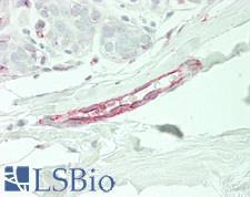 ETK / BMX Antibody - Human Breast, Vessel: Formalin-Fixed, Paraffin-Embedded (FFPE)