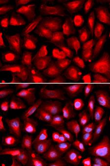 ETS1 / ETS-1 Antibody - Immunofluorescence analysis of U2OS cell using ETS1 antibody. Blue: DAPI for nuclear staining.