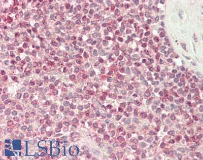 ETS1 / ETS-1 Antibody - Human Spleen: Formalin-Fixed, Paraffin-Embedded (FFPE)