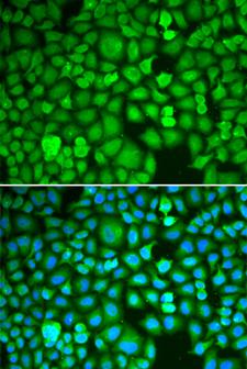 ETS1 / ETS-1 Antibody - Immunofluorescence analysis of A549 cells using ETS1 antibody. Blue: DAPI for nuclear staining.