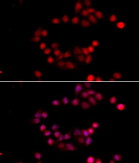 ETS1 / ETS-1 Antibody - Immunofluorescence analysis of HeLa cells using ETS1 antibodyat dilution of 1:100 (40x lens). Blue: DAPI for nuclear staining.
