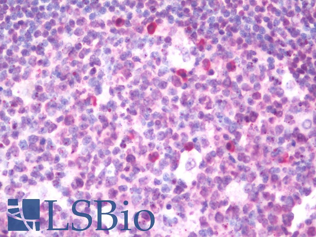 ETS2 Antibody - Anti-ETS2 antibody IHC staining of human tonsil. Immunohistochemistry of formalin-fixed, paraffin-embedded tissue after heat-induced antigen retrieval. Antibody dilution 1:75.