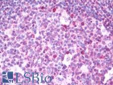 ETS2 Antibody - Anti-ETS2 antibody IHC staining of human tonsil. Immunohistochemistry of formalin-fixed, paraffin-embedded tissue after heat-induced antigen retrieval. Antibody dilution 1:75.