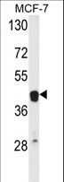 ETS2 Antibody - Western blot of ETS2 Antibody in MCF-7 cell line lysates (35 ug/lane). ETS2 (arrow) was detected using the purified antibody.