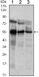 ETV5 / ERM Antibody - Western blot using ETV5 mouse monoclonal antibody against Jurkat (1), NIH/3T3 (2) and MCF-7 (3) cell lysate.