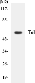ETV6 / TEL Antibody - Western blot analysis of the lysates from HeLa cells using Tel antibody.