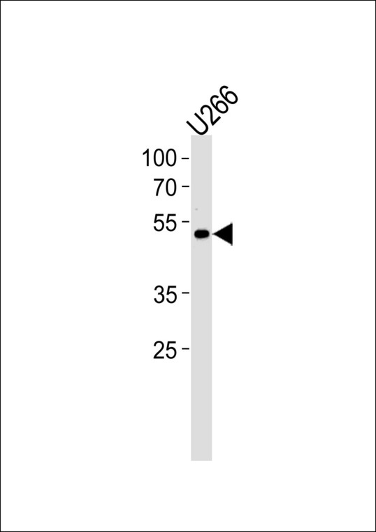 ETV6 / TEL Antibody - ETV6 Antibody western blot of U266 cell line lysates (35 ug/lane). The ETV6 antibody detected the ETV6 protein (arrow).