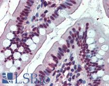EWSR1 / EWS Antibody - Anti-EWSR1 antibody IHC of human small intestine. Immunohistochemistry of formalin-fixed, paraffin-embedded tissue after heat-induced antigen retrieval. Antibody concentration 3.75 ug/ml.