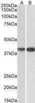 EXOG / ENDOGL1 Antibody - EXOG / ENDOGL1 antibody (0.2µg/ml) staining of HepG2 (A) and Jurkat (B) lysates (35µg protein in RIPA buffer). Detected by chemiluminescence.
