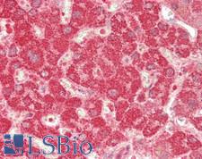 EXT1 Antibody - Human Liver: Formalin-Fixed, Paraffin-Embedded (FFPE)