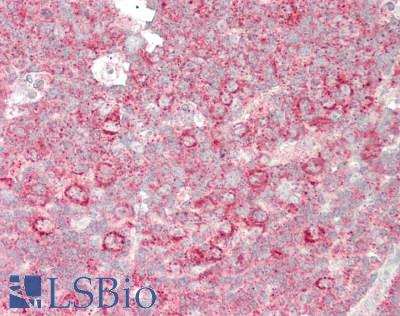 EXT1 Antibody - Human Tonsil: Formalin-Fixed, Paraffin-Embedded (FFPE)